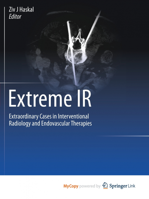 Extreme IR