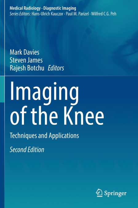 Imaging of the Knee