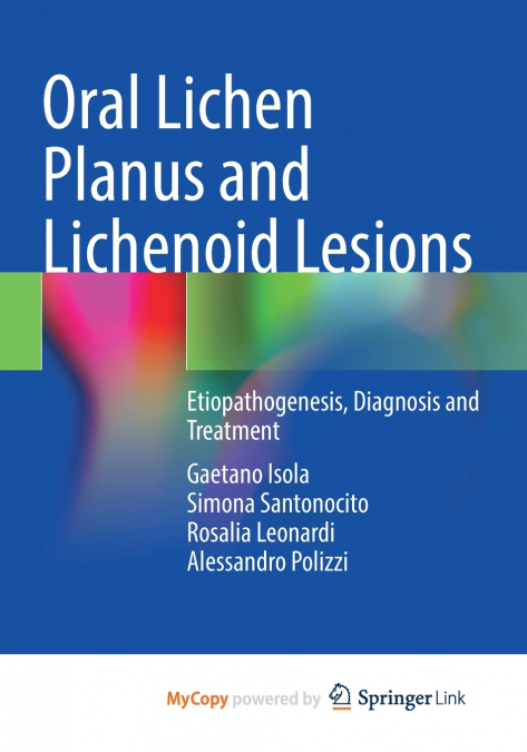 Oral Lichen Planus and Lichenoid Lesions