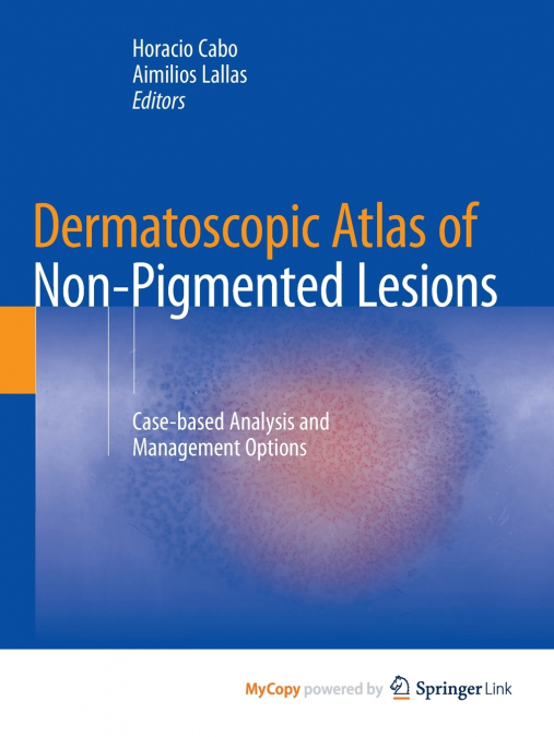 Dermatoscopic Atlas of Non-Pigmented Lesions
