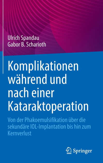 Komplikationen während und nach einer Kataraktoperation