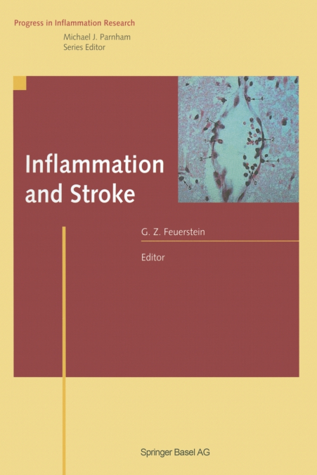 Inflammation and Stroke
