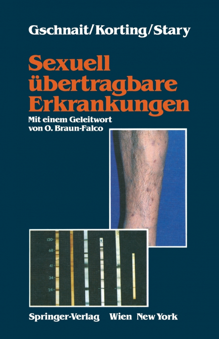 Sexuell Ubertragbare Erkrankungen