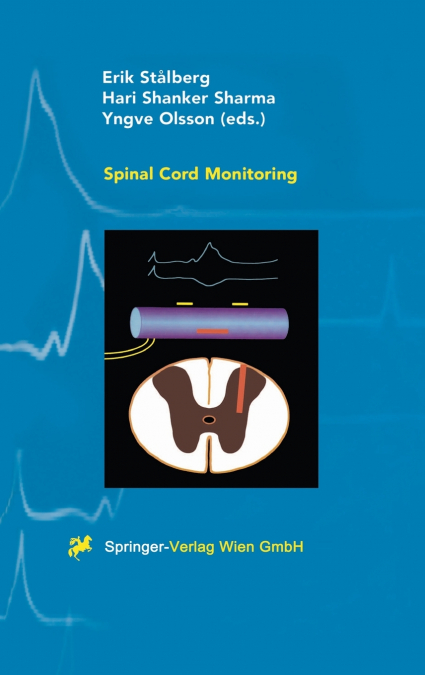 Spinal Cord Monitoring