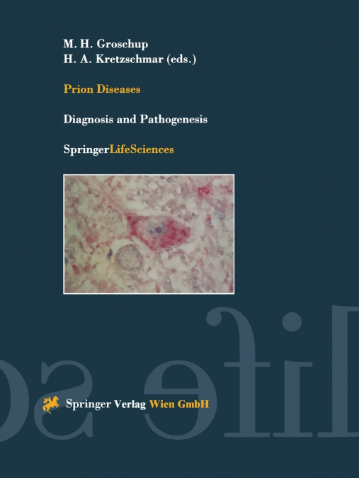 Prion Diseases