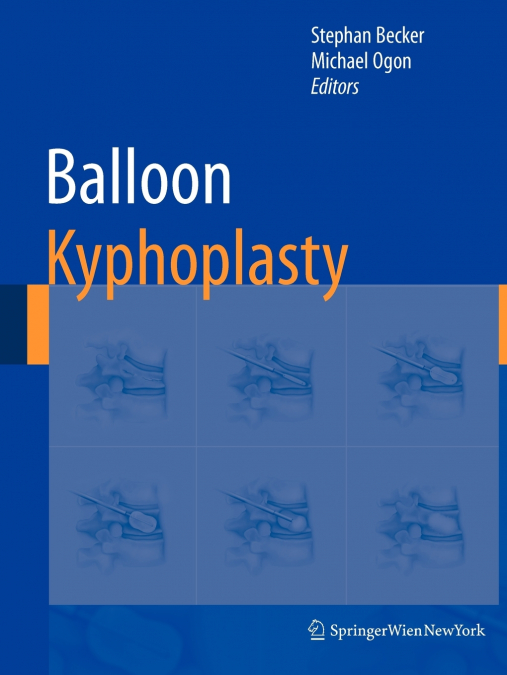 Balloon Kyphoplasty