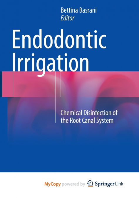 Endodontic Irrigation