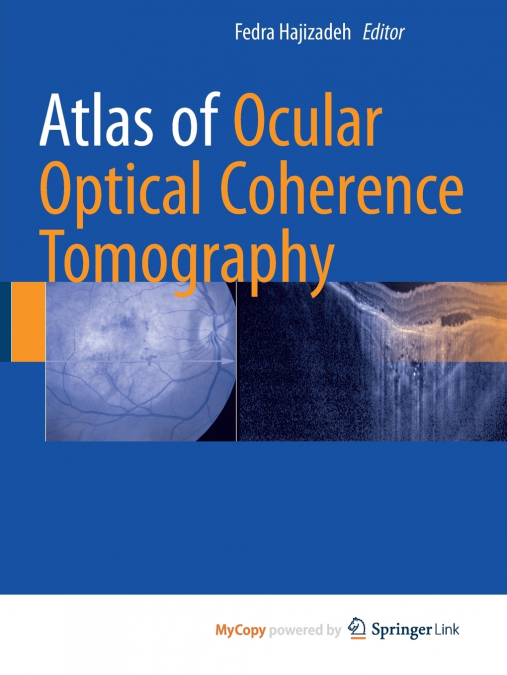 Atlas of Ocular Optical Coherence Tomography