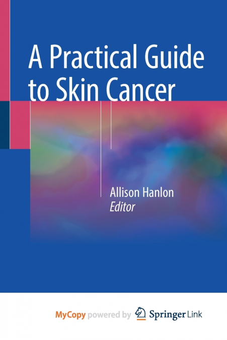 A Practical Guide to Skin Cancer
