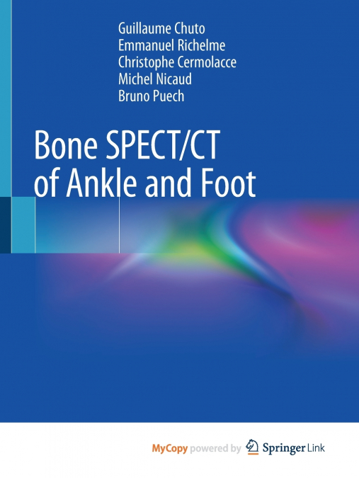 Bone SPECT/CT of Ankle and Foot