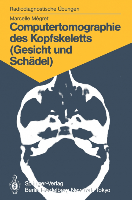 Computertomographie des Kopfskeletts (Gesicht und Schädel)