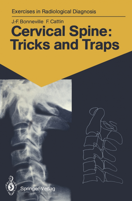 Cervical Spine