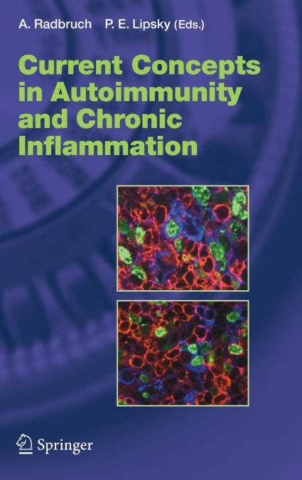 Current Concepts in Autoimmunity and Chronic Inflammation