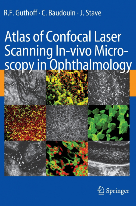 Atlas of Confocal Laser Scanning In-vivo Microscopy in Ophthalmology