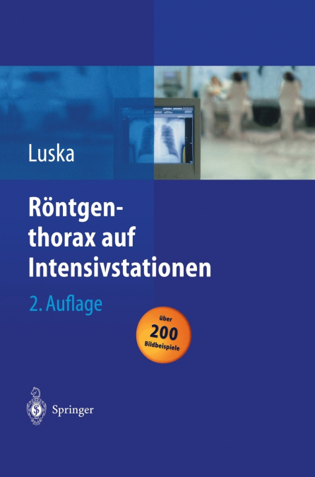 Röntgenthorax auf Intensivstationen