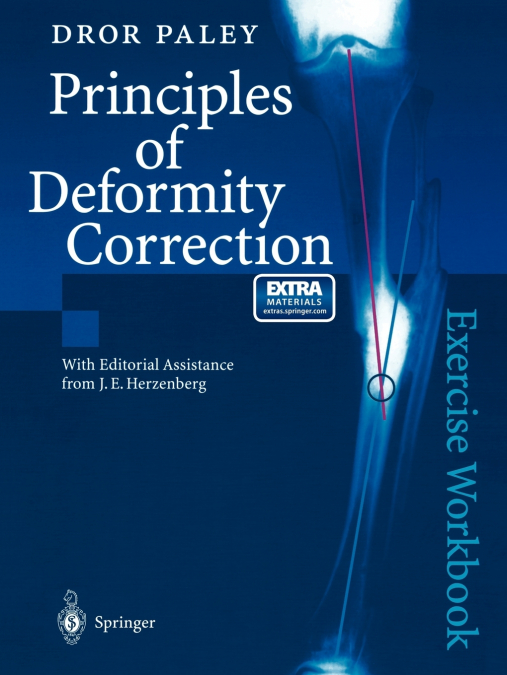 Principles of Deformity Correction