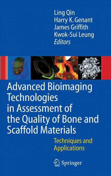 Advanced Bioimaging Technologies in Assessment of the Quality of Bone and Scaffold Materials