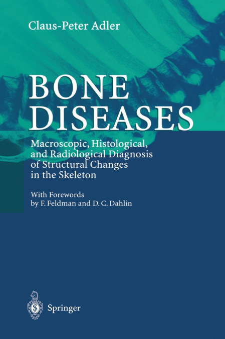 Bone Diseases