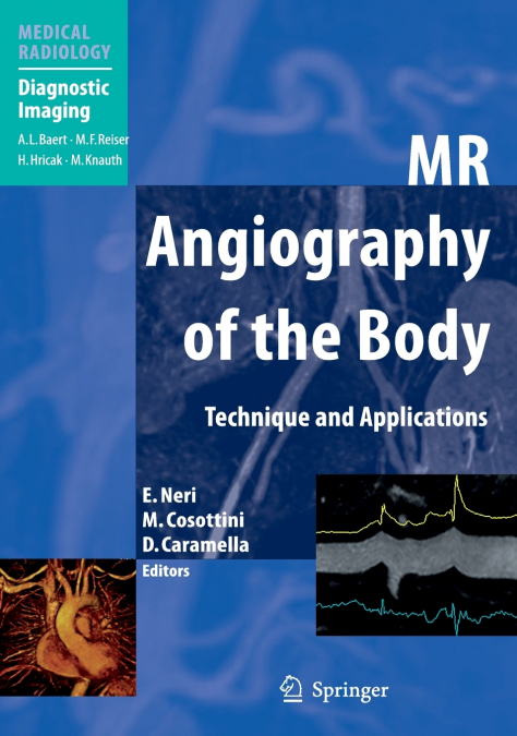 MR Angiography of the Body