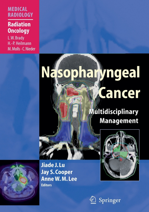 Nasopharyngeal Cancer