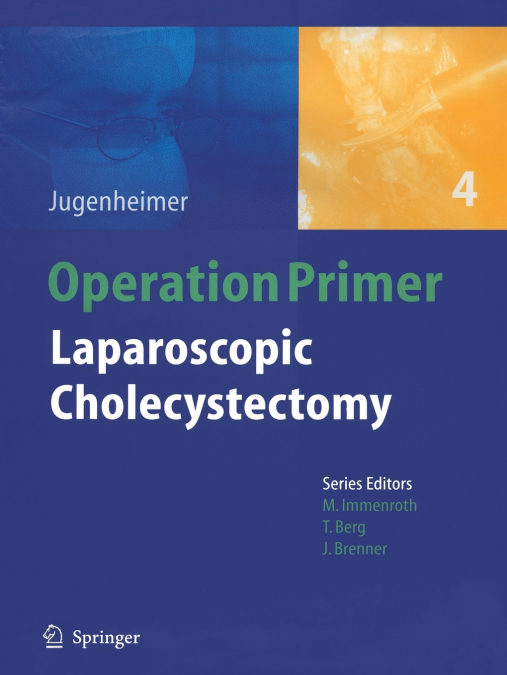 Laparoscopic Cholecystectomy