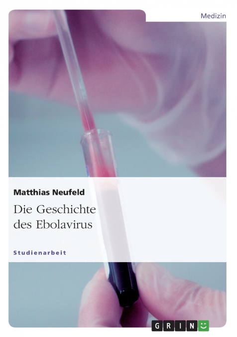 Die Geschichte des Ebolavirus