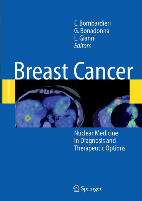 Breast Cancer