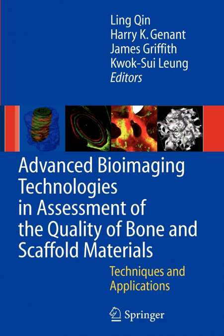 Advanced Bioimaging Technologies in Assessment of the Quality of Bone and Scaffold Materials