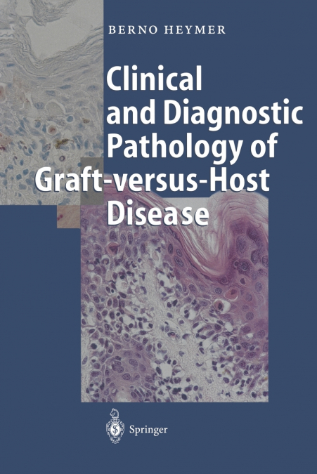 Clinical and Diagnostic Pathology of Graft-versus-Host Disease