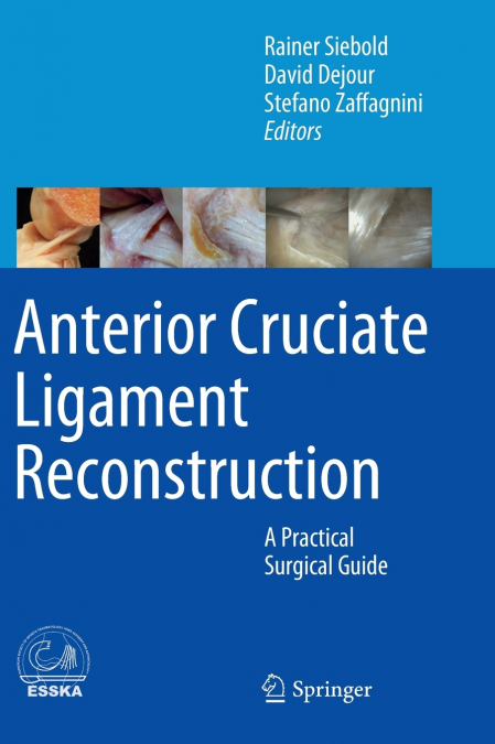 Anterior Cruciate Ligament Reconstruction