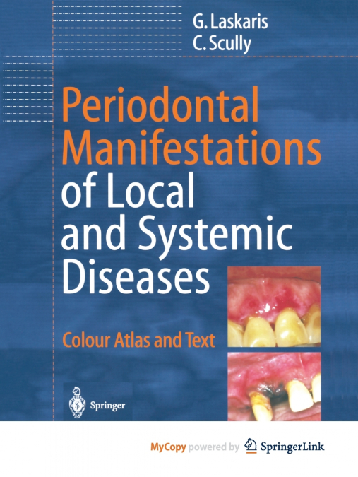 Periodontal Manifestations of Local and Systemic Diseases