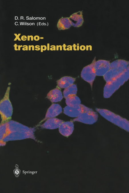 Xenotransplantation