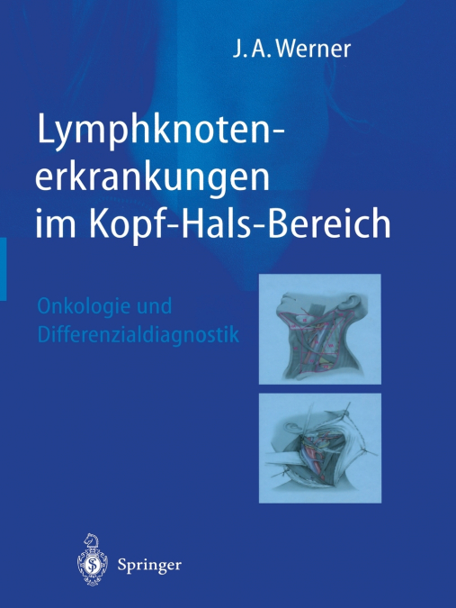 Lymphknotenerkrankungen Im Kopf-Hals-Bereich