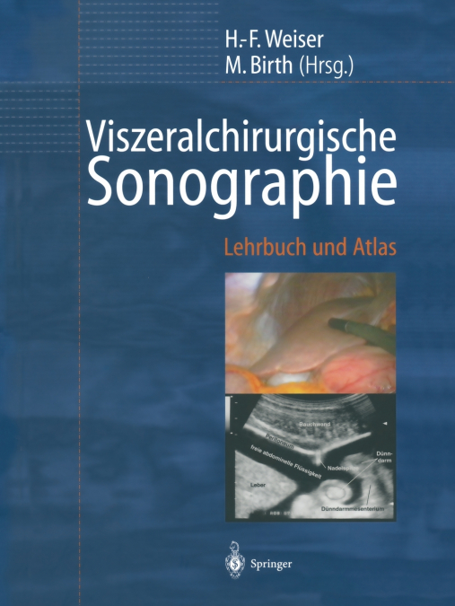 Viszeralchirurgische Sonographie