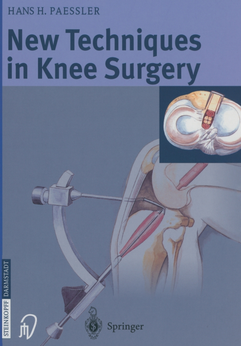 New Techniques in Knee Surgery