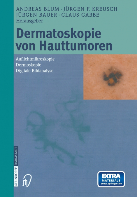 Dermatoskopie von Hauttumoren