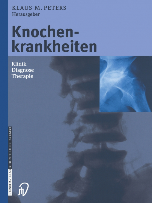 Knochenkrankheiten