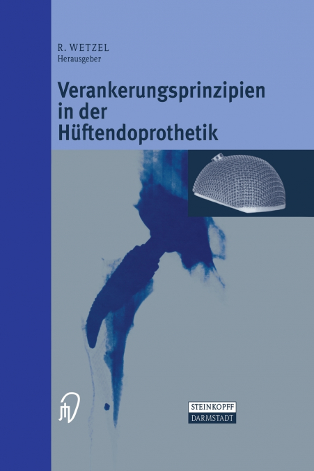 Verankerungsprinzipien in Der Huftendoprothetik