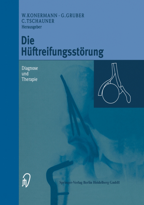 Die Huftreifungsstorung