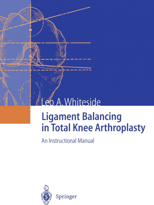 Ligament Balancing in Total Knee Arthroplasty