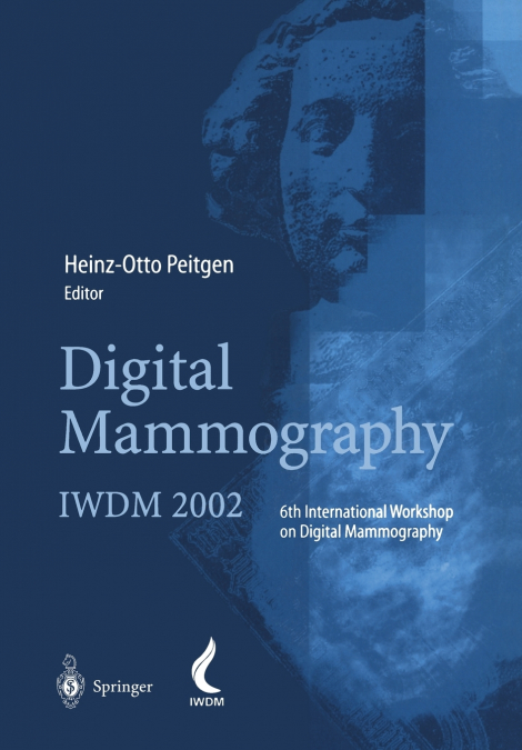 Digital Mammography