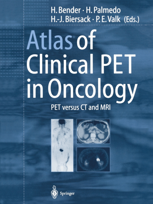 Atlas of Clinical Pet in Oncology
