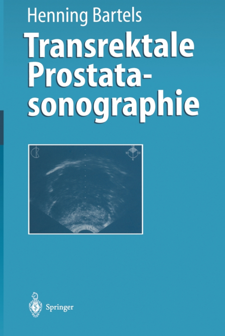 Transrektale Prostatasonographie