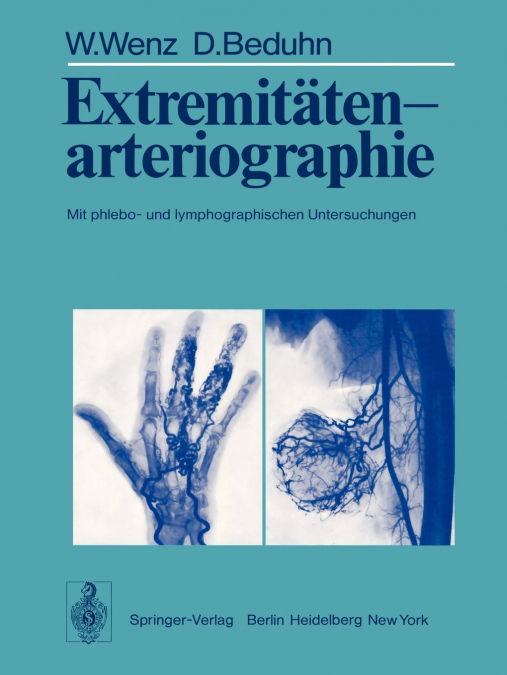 Extremitätenarteriographie