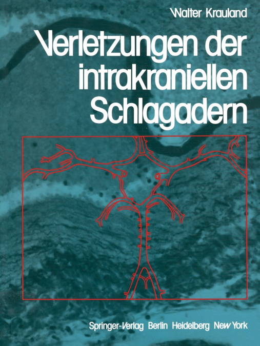 Verletzungen Der Intrakraniellen Schlagadern
