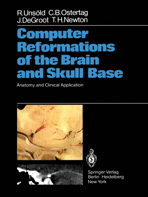 Computer Reformations of the Brain and Skull Base