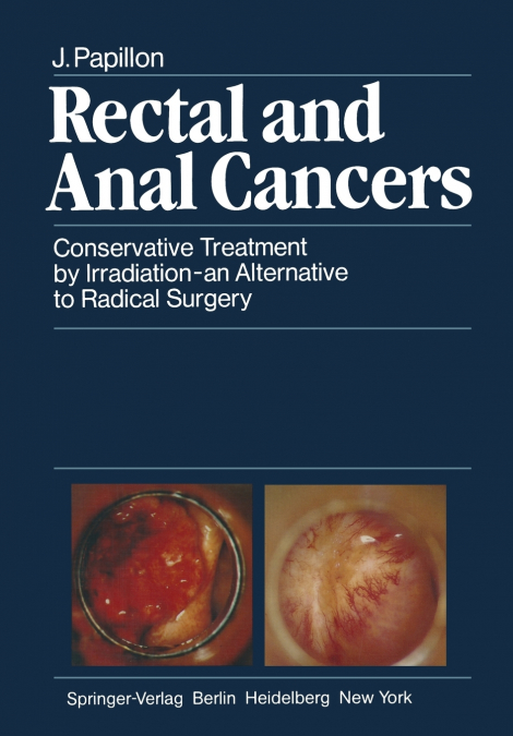 Rectal and Anal Cancers