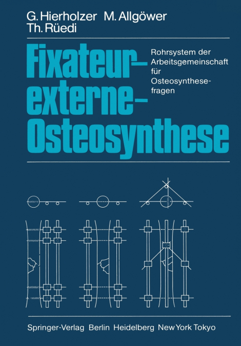 Fixateur-externe-Osteosynthese
