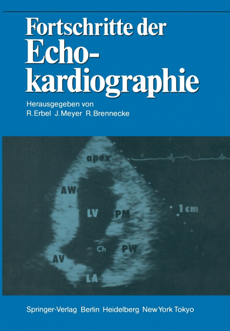 Fortschritte der Echokardiographie