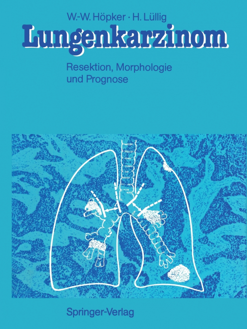 Lungenkarzinom